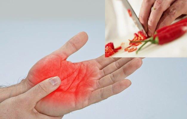 hvordan bli kvitt pepper smerte i hånden