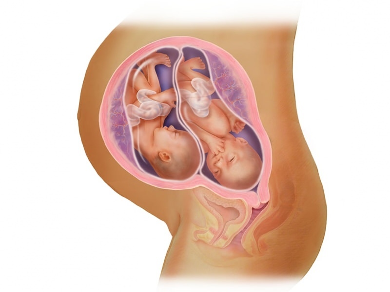 Tvillinggraviditet i IVF! Hva er embryooverføring?