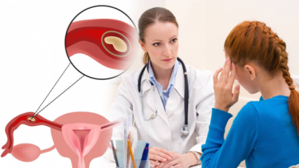 Hva er ektopisk graviditet (ektob graviditet), hvorfor? Hva er tegnene på graviditet utenfor livmoren?
