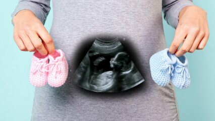 Vil kjønnet til babyen bli bestemt i graviditetens første trimester?