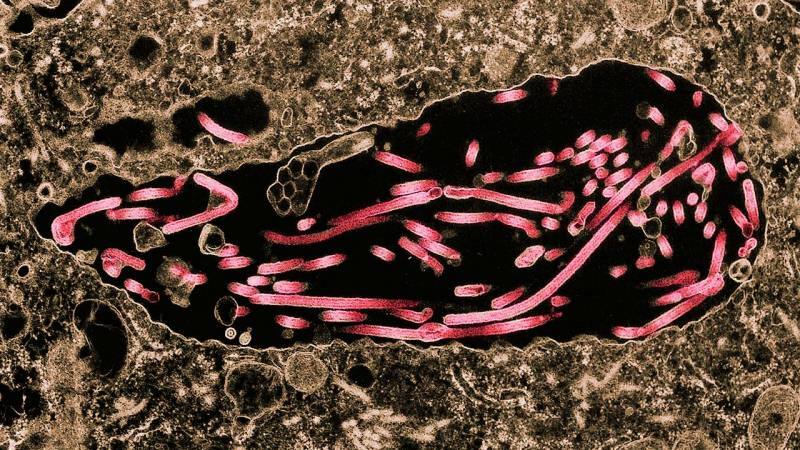 bilde av ebolansk spredning til celler