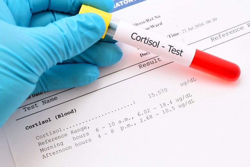 kortisolnivå forekommer i blodprøver