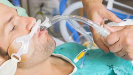 Hva er intubasjonen som Fahrettin Koca sa? Hva betyr det å intubere pasient? Vil den intuberte pasienten komme seg?