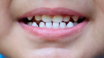 Hvordan lære barn tannpleie?