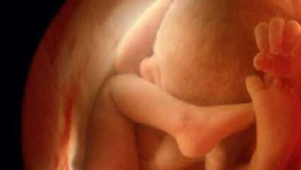 Viser ikke babyens kjønn på ultralyd! Hvordan ser babygutter og jenter ut på ultralyd?