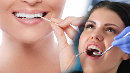 Hvordan opprettholde munn- og tannhelsen? Hva bør vurderes ved rengjøring av tenner?