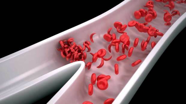 irritabilitet og tretthet øker når blodcellene avtar