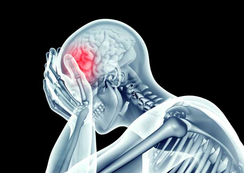croonavirus skader hjernen ved å begrense karene