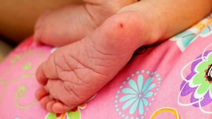 Hvorfor tas hælblod hos spedbarn? Krav til test av hælblod hos spedbarn