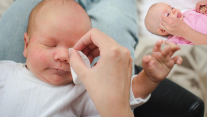 Hvordan fjerne grater hos babyer? Forårsaker øyehull hos babyer? Burr massasje med morsmelk