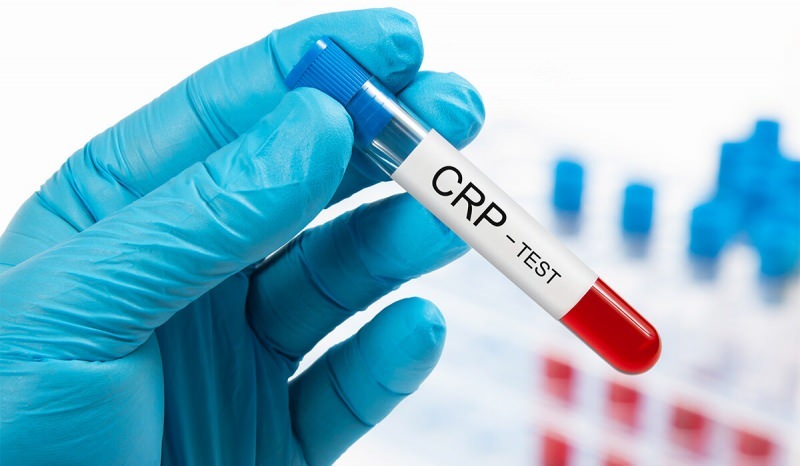 Hvorfor stiger CRP i blodet? Hva er CRP? Hvordan senker jeg CRP?