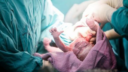 Graviditetsordbok fra A til Å! Medisinske termer å vite om graviditet og fødsel