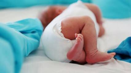 Bør babyer ha hofteultralyd?