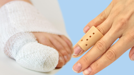 Hva forårsaker fingerbrudd? Hva er symptomene på fingerbrudd?