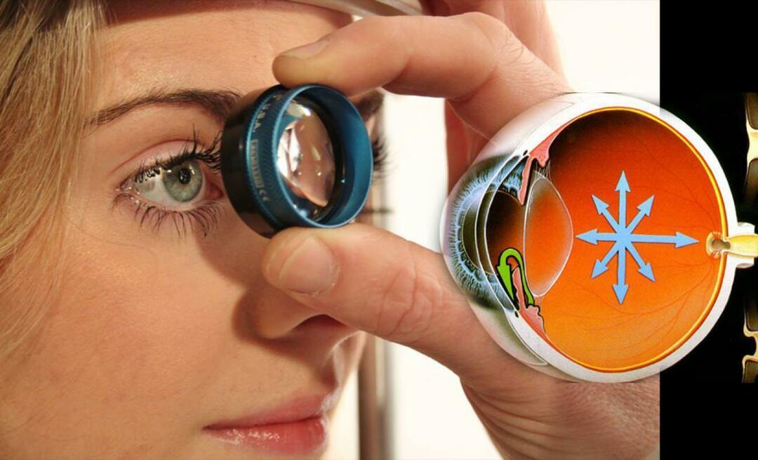 Hva er glaukom? Vær oppmerksom på denne sykdommen som utvikler seg snikende uten å gi noen symptomer!