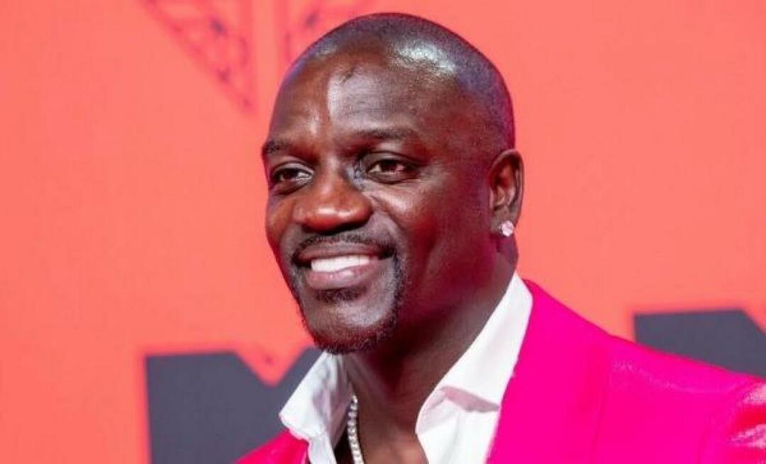 Den amerikanske sangeren Akon foretrakk også Tyrkia for hårtransplantasjon! Her er prisen han betalte...