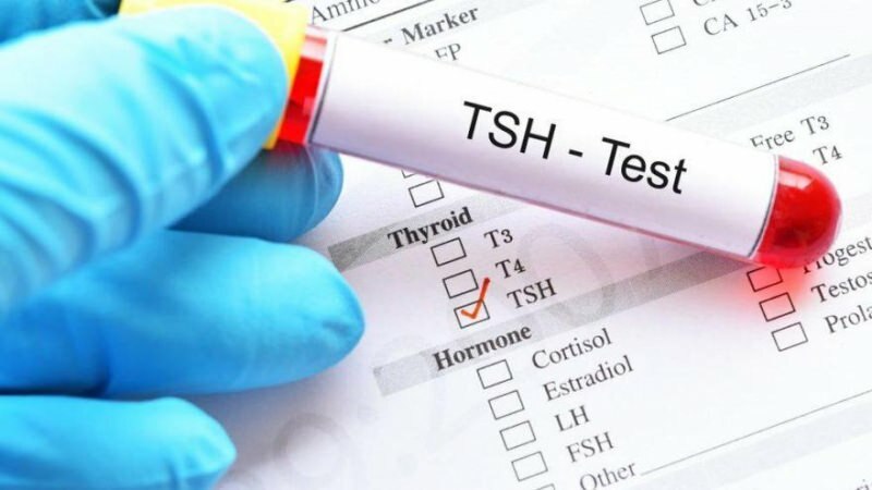 Hva er TSH-testen? Hva er symptomene på TSH? Hva betyr TSH høyt og lavt?
