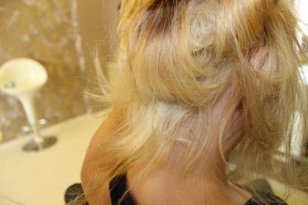 Hva gjøres med det brennende håret fra midten? Hvordan skal det behandlede håret opprettholdes?