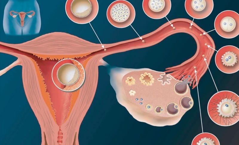 Hva er implantasjon? Hvordan skille mellom blødning og menstruasjonsblødning? Farge og konsistens ...
