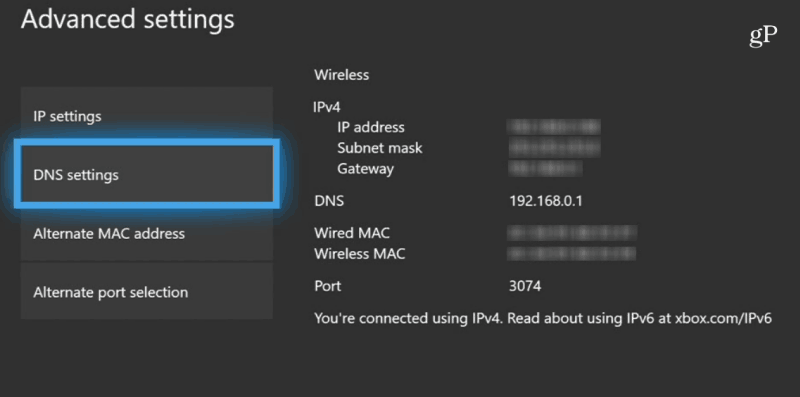 Xbox One DNS-innstillinger