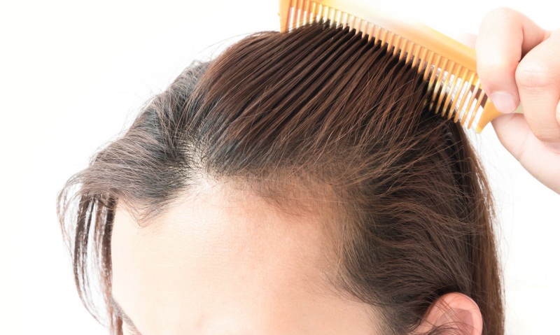 håravfallsløsninger etter fødsel! Hva er bra for håravfall?