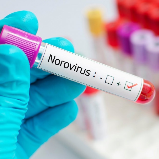 Hva er norovirus og hva sykdommer forårsaker