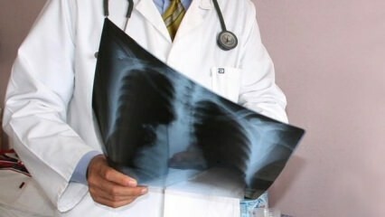 Eksperter kunngjort! Økning i dødsfall i lungekreft