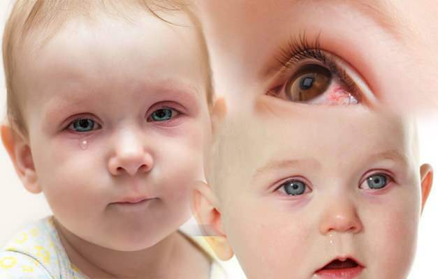forårsaker øyeblødning hos babyer