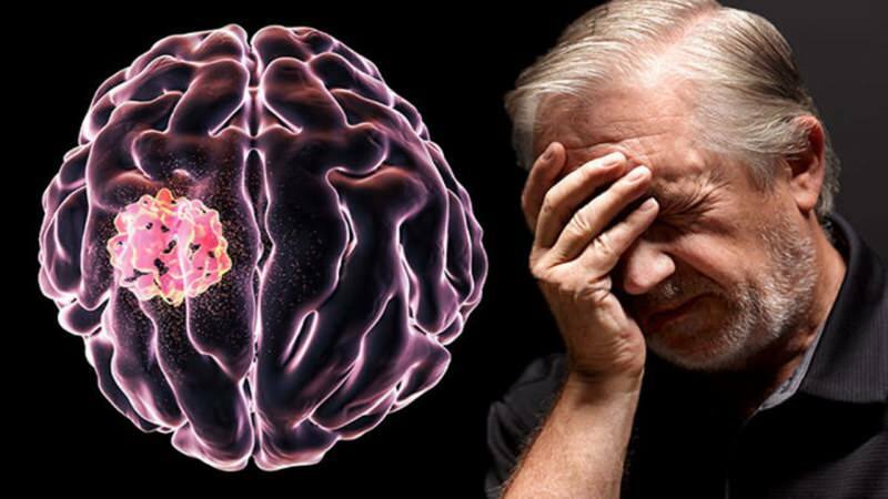 Vevet som dannes i hjernen ved forstyrrelse av cellestrukturer kalles en svulst.