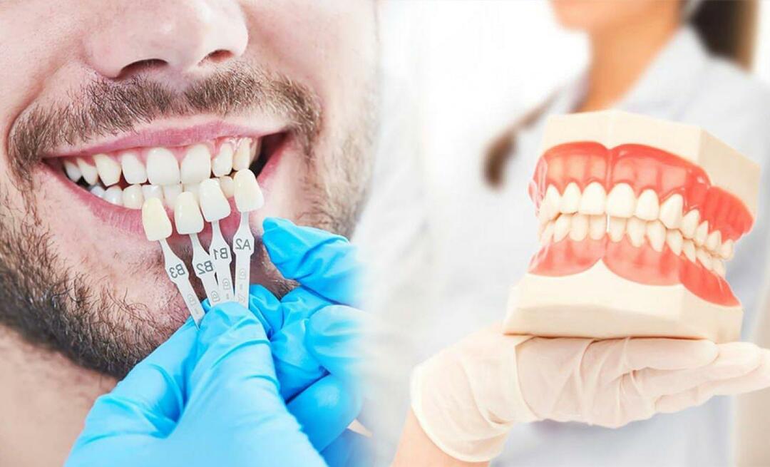 Hvorfor påføres zirkoniumkroner på tennene? Hvor holdbart er zirkoniumbelegget?