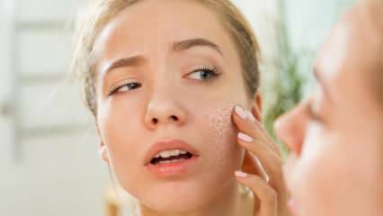 Hvorfor tørker huden? Hva gjør du på tørr hud? De mest effektive pleie anbefalingene for tørr hud