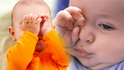 Naturlige løsninger for øyebrann hos babyer