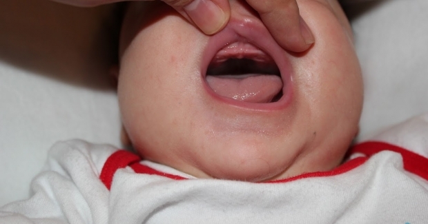 Hva er ganenesfall hos babyer, hvorfor? Symptomer og behandling ...