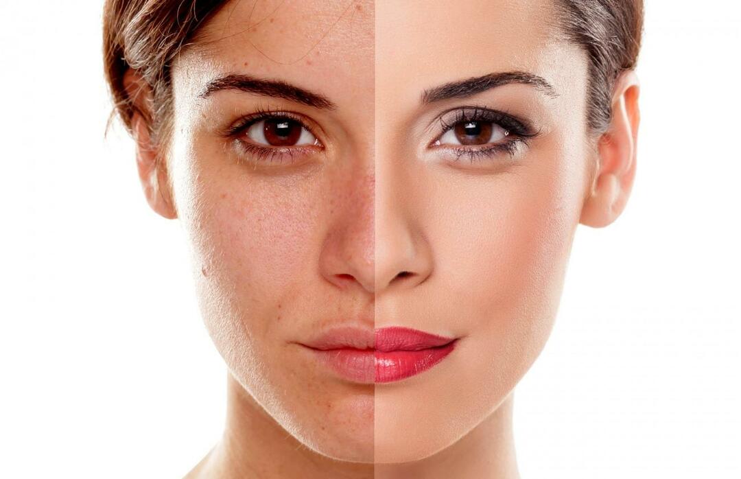 Hvordan forhindrer vi at huden ser sliten ut? Hvordan redusere det slitne utseendet på huden?