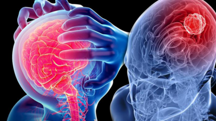 Hva er degenerasjon av cerebellum (ryggmarg)? Hva er symptomene på lillehjernen?