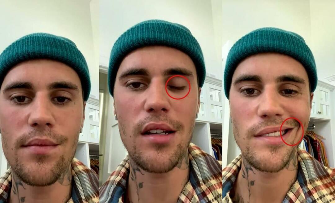 Justin Bieber hadde en ansiktslammelse! Den kjente stjernen kan ikke dra på verdensturné igjen