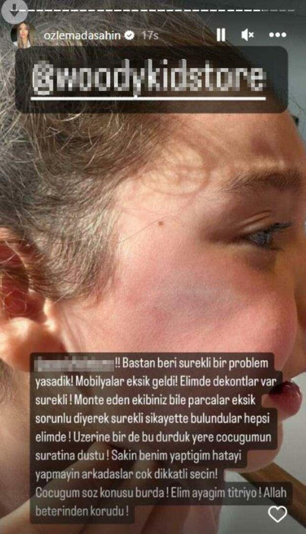 Garderobedøren falt på Berkay Şahins datters ansikt