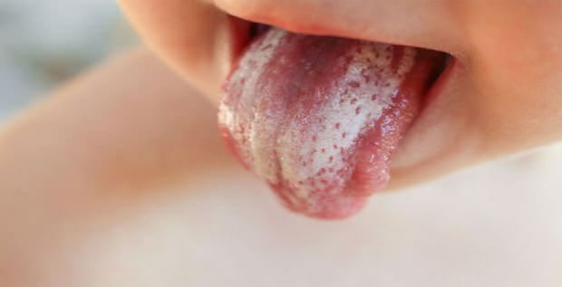 Oral soppbehandling hos spedbarn
