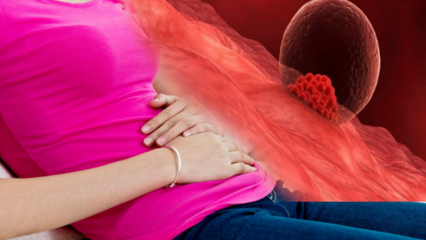 Hva er implantasjonsblødning under graviditet? Hvordan skille mellom implantasjonsblødning og menstruasjonsblødning